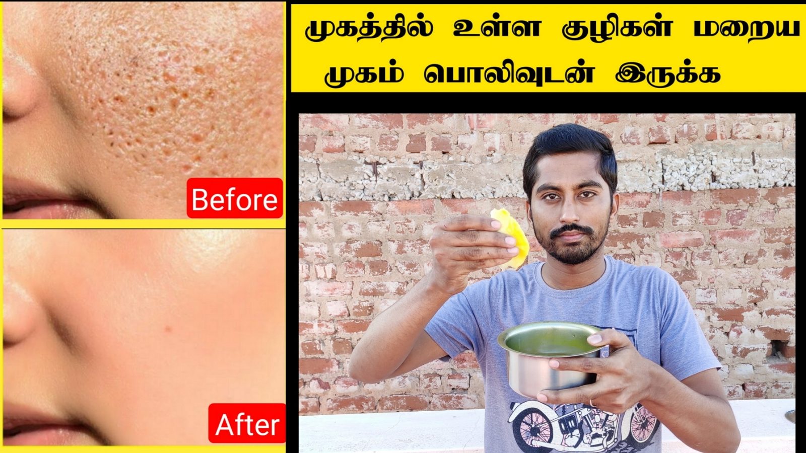 How to remove large open pores naturally in Tamil and to get clear face | Home remedy for open pores