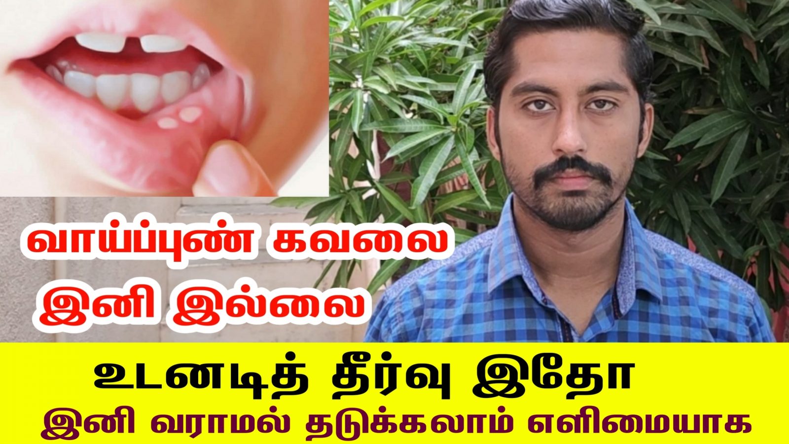 வாய்ப்புண் உடனடியாக குணமாக வேண்டுமா? இனி வராமல் தடுக்கலாம் எளிமையாக | Mouth Ulcer Treatment in Tamil