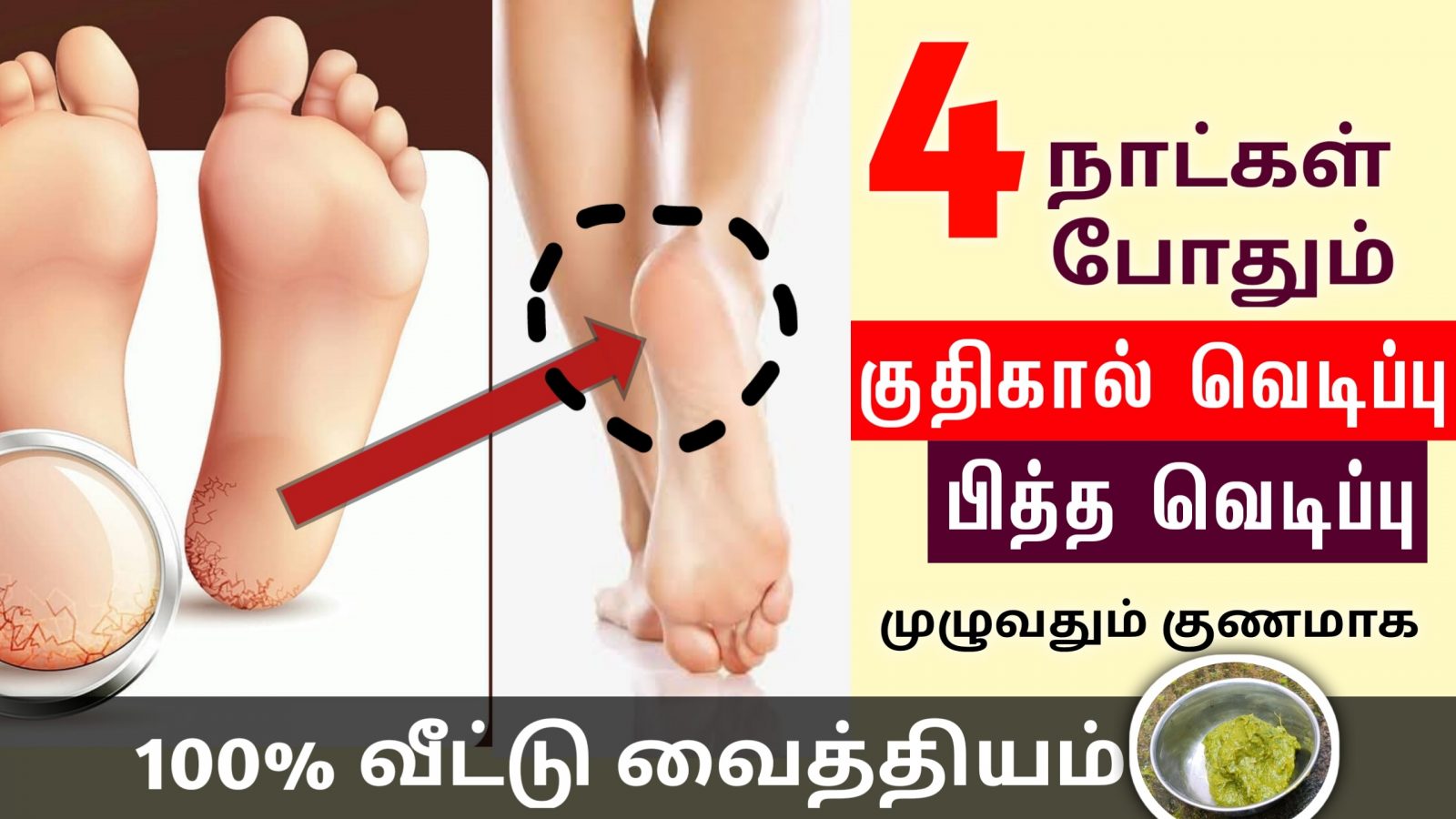 பாத வெடிப்பு நீங்க | Cracked Heels Home Remedies in Tamil | Patha vedippu tips | Next Day 360
